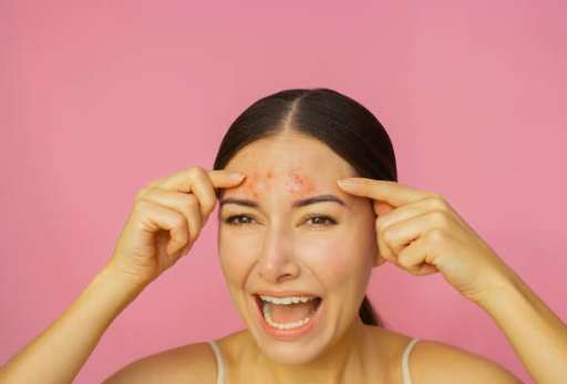 Top 5 Foods That Are Ruining Your Skin – K-Beauty’s Guide to What to Avoid