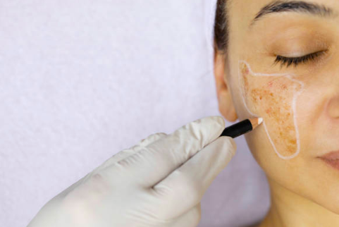 How to Tackle Pigmentation & Scars with K-Beauty Products