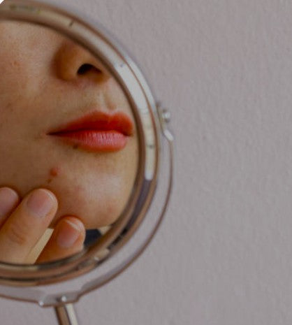 Why Your Skin Barrier Is Damaged – And How K-Beauty Can Fix It Naturally